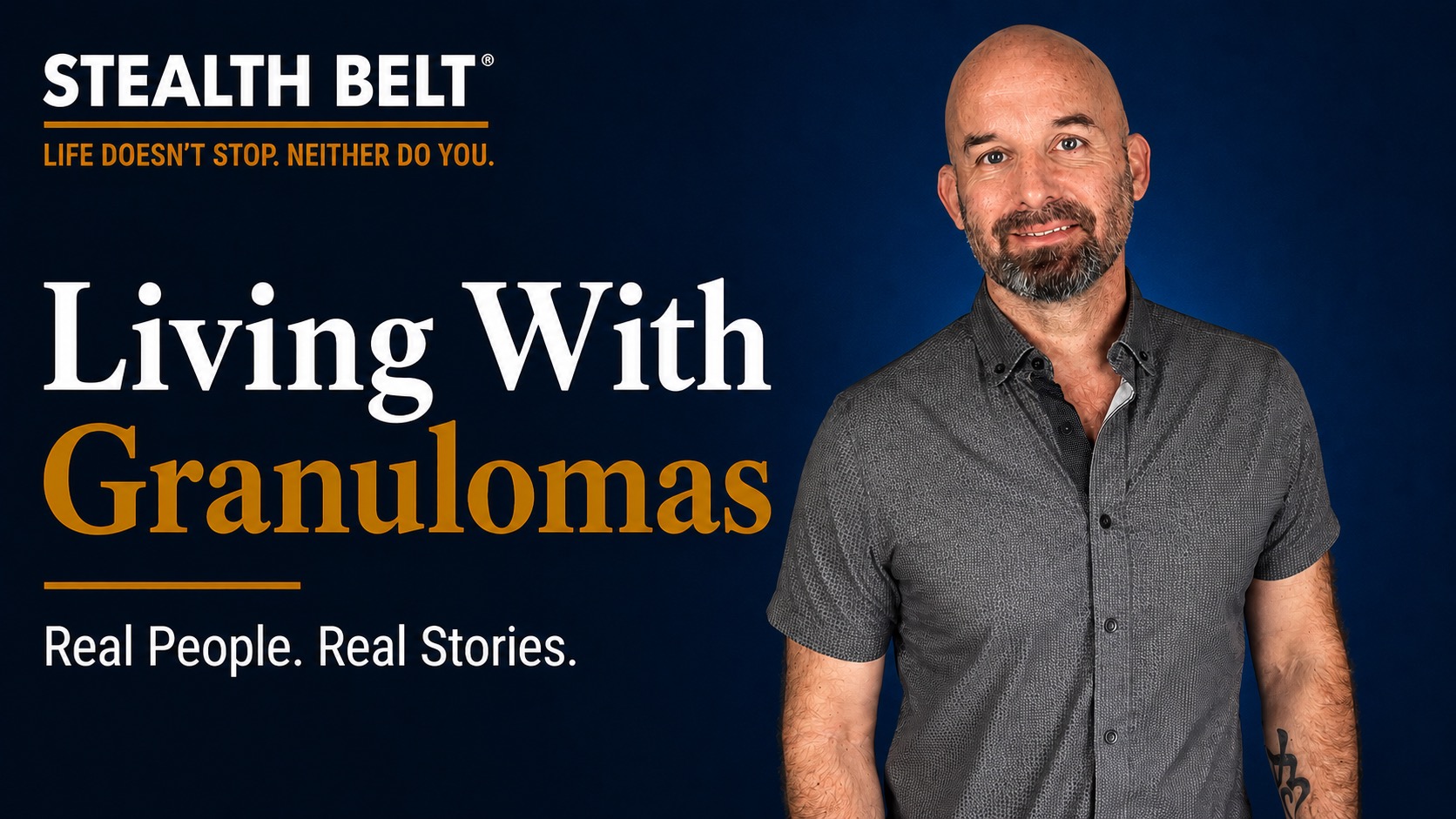 Living With Stoma Granulomas: One of the Most Frustrating Parts of My Ostomy